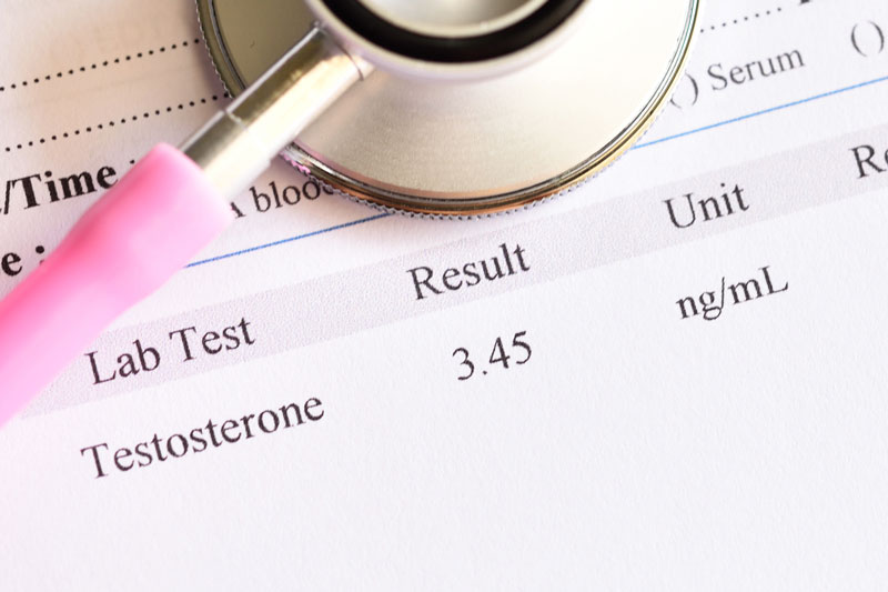 Testosterone Replacement